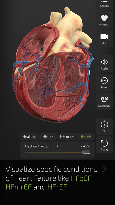 INSIGHT HEART app screenshot 4