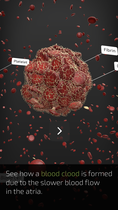 INSIGHT HEART app screenshot 7